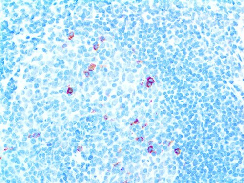 IHC of CD57 on an FFPE Tonsil Tissue